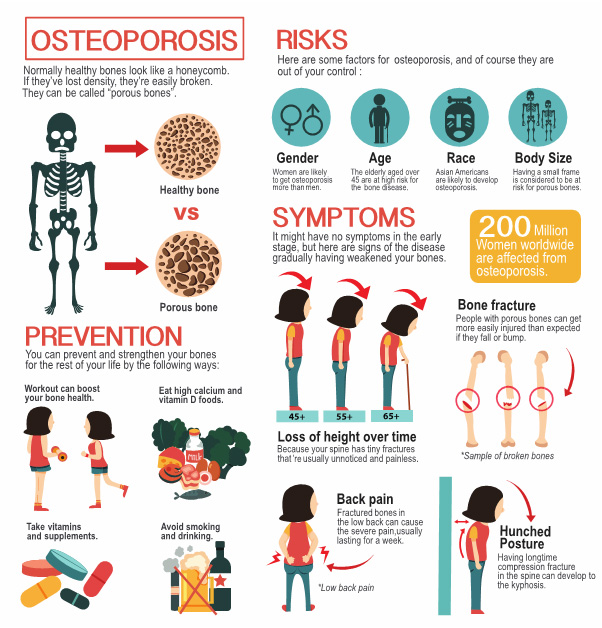 Bone health and exercise guidelines