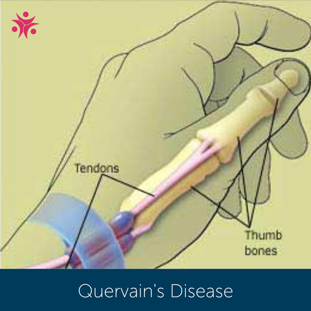 Video Games And Gamer’s Thumb What’s The Go?