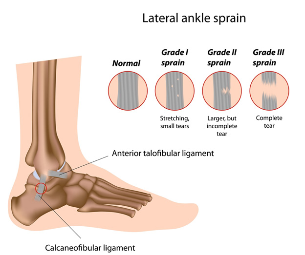 5 Most Common Injuries In Soccer What You Need To Know