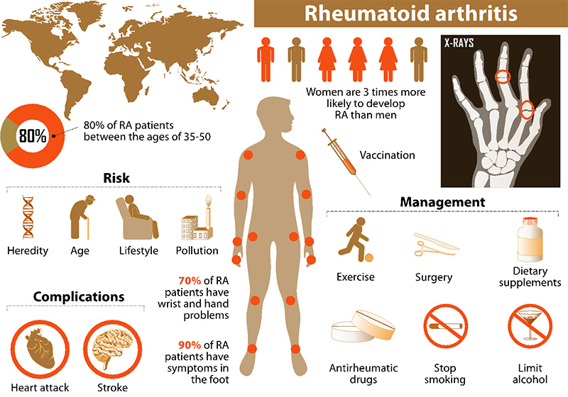 What is the difference between osteoarthritis and rheumatoid arthritis? 