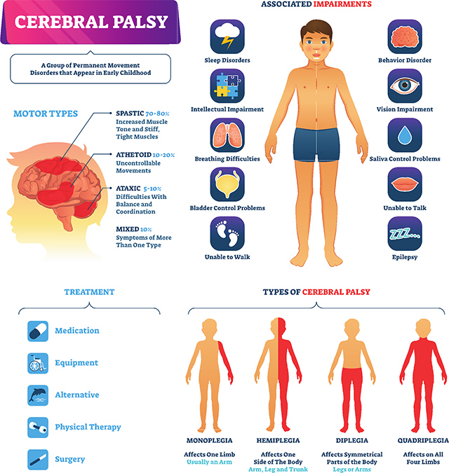 What Role Does Physiotherapy Play in the Management of Cerebral Palsy?
