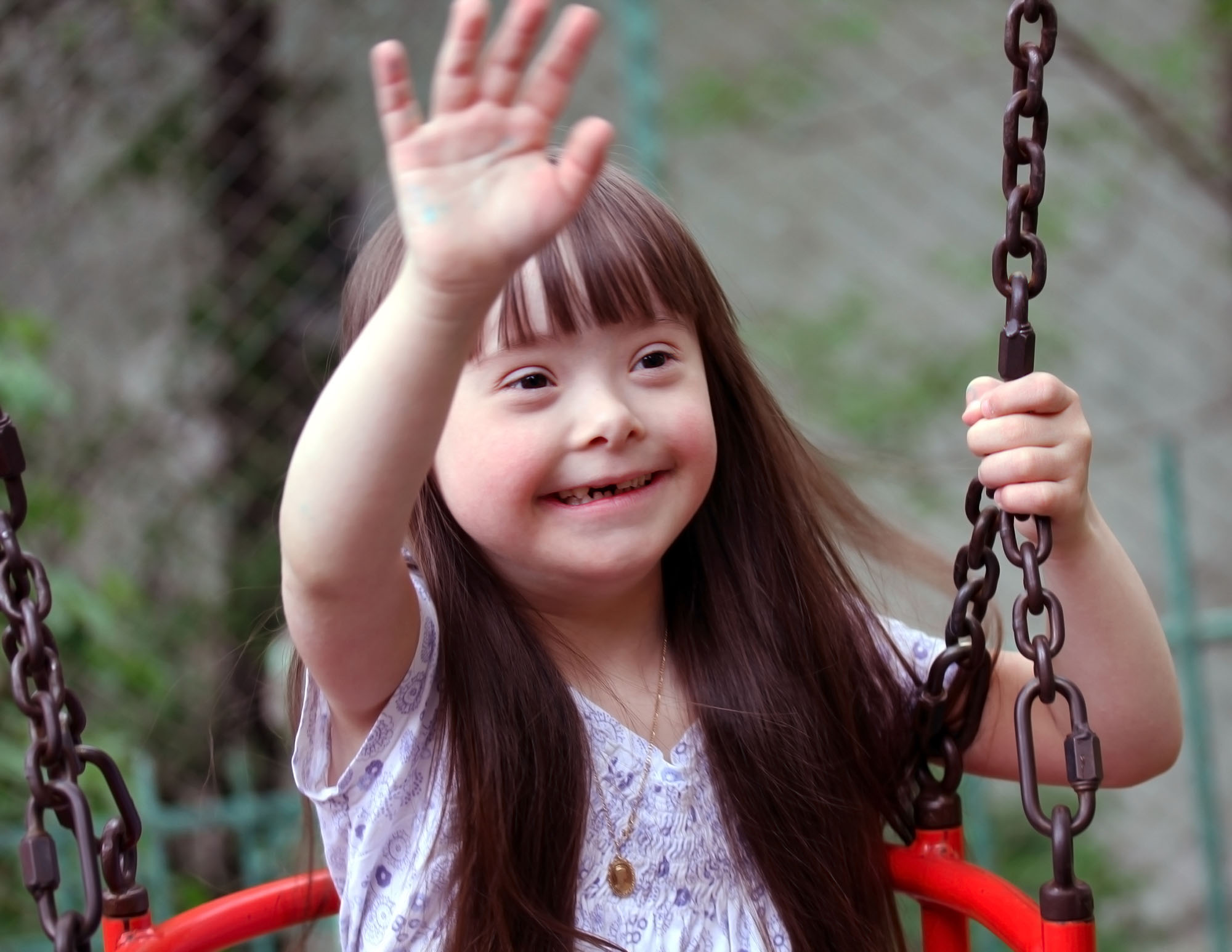 Children With Down Syndrome - Physical Complications & What You Can Do About Them?